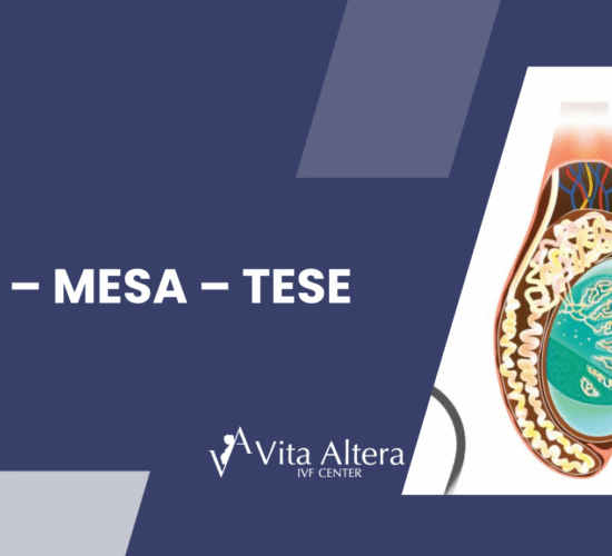 Pesa – Mesa – Tese in Cyprus
