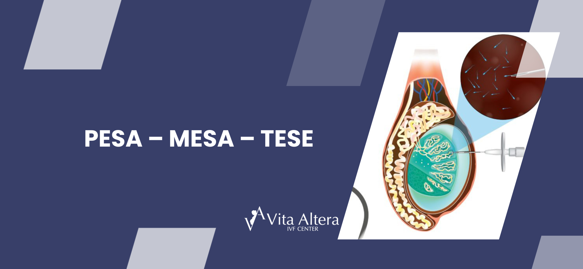 Pesa – Mesa – Tese in Cyprus