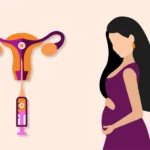 Embryo Transfer