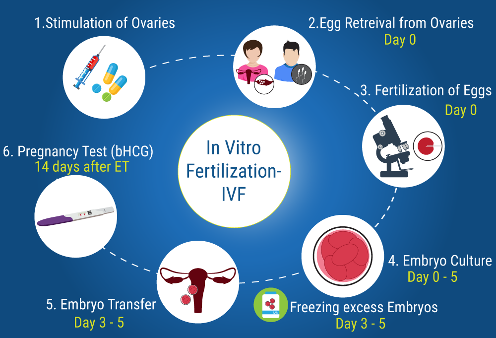 IVF-Steps