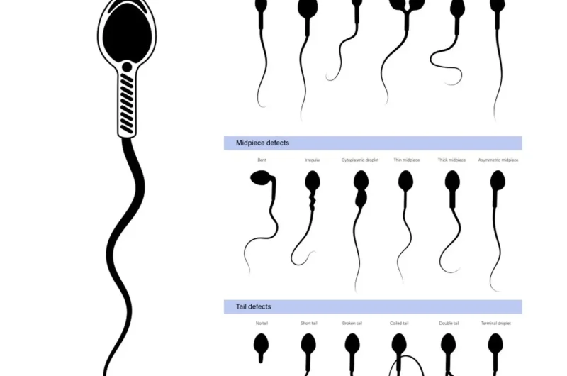 Sperm Morphology: What It Is and How It Affects Fertility