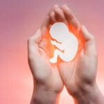 Recurrent Miscarriage