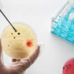 Sperm Analysis