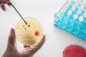 Sperm-Analysis