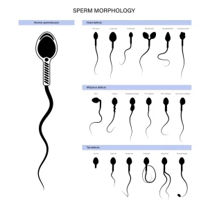 Sperm-Morphology