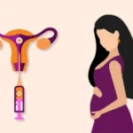 Embryo Transfer