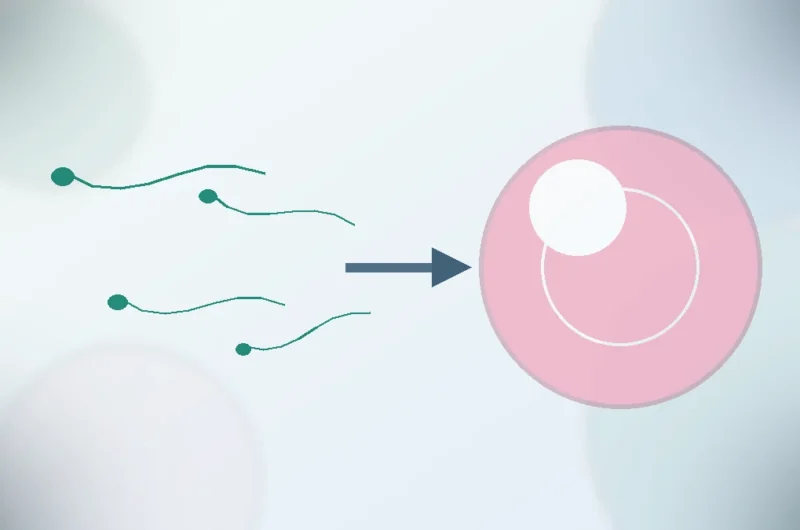 Yumurta ve sperm sorunu birlikteyse IVF, ICSI, tandem, yumurta, sperm ve embriyo donasyonu seçenekleri.